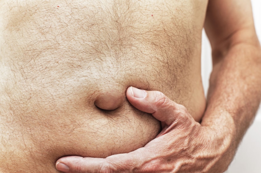 Holiday Hernias.jpg